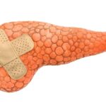 ガストリノーマを予防するのに今マグネシウムが注目されている?