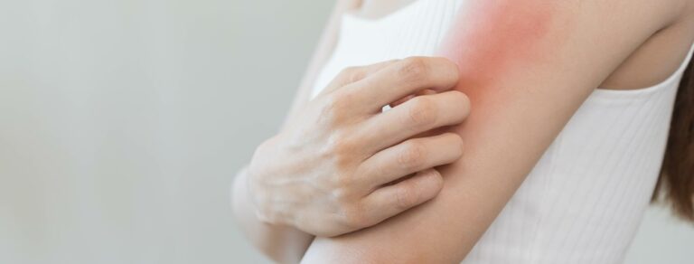 ストレス性皮膚炎を予防するのに今マグネシウムが注目されている？